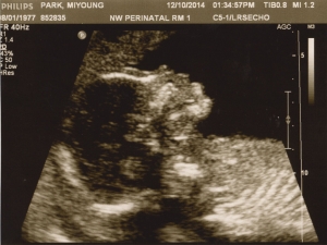 ultrasound 2014-12-10 10.jpg